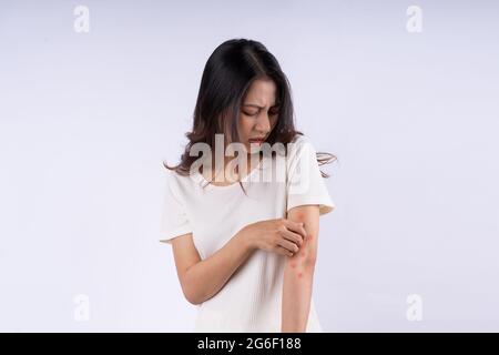 Portrait d'une femme asiatique avec démangeaisons isolées sur fond blanc Banque D'Images