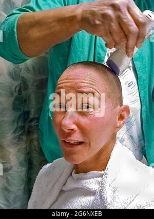 Une femme américaine qui souffre d'épilepsie a sa tête rasée avec un rasoir électrique dans un hôpital avant une opération sur son cerveau. Ses cheveux ont été complètement retirés avant que le chirurgien ne coupe son cuir chevelu et son crâne (crâne) pour effectuer une lobectomie temporelle, une chirurgie qui peut abaisser le nombre de convulsions, les rendre moins sévères, ou même les arrêter de se produire. Au cours de cette procédure médicale, le médecin enlève une partie du lobe temporal de son cerveau où la plupart des crises commencent. (1er sur 7 images connexes.) Modèle libéré. Banque D'Images