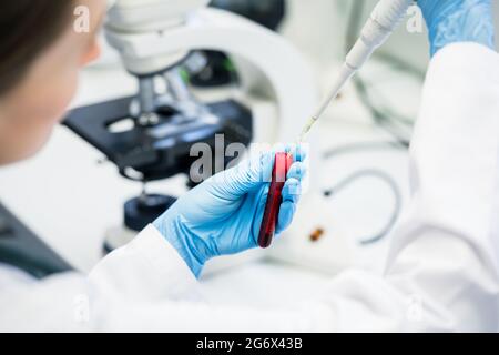 Médecin ou assistant de laboratoire mettant la solution dans le test sanguin au laboratoire à examiner au microscope Banque D'Images