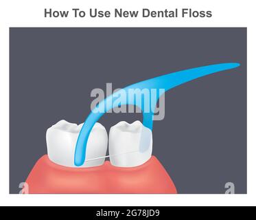 Comment utiliser une nouvelle soie dentaire. Illustration des dents et des gencives saines en utilisant une nouvelle soie dentaire. Illustration de Vecteur