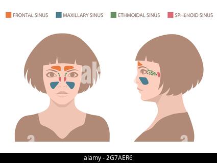 sinusite, illustration du nez vectoriel, anatomie sinusale, système respiratoire humain Illustration de Vecteur