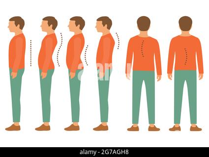 scoliose, maladie de la colonne vertébrale de la lordose, défaut de posture du dos Illustration de Vecteur
