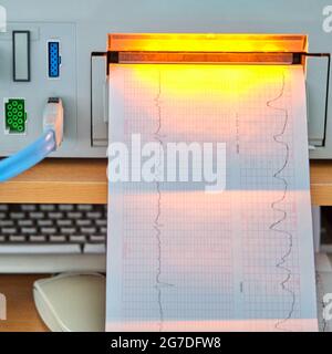 Dispositif CTG avec surveillance de l'état de santé de la mère et de l'enfant pendant l'accouchement à l'hôpital. Cardiographe pour la mesure du Banque D'Images