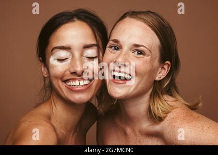 Gros plan de jeunes femmes heureuses avec une peau différente sur fond marron. Portrait de femmes avec une peau unique dans l'humeur gaie. Banque D'Images
