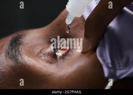 Addis-Abeba, Éthiopie. 30 juin 2021. Des gouttes oculaires sont placées dans l'œil d'un patient qui a reçu une greffe de cornée à la Banque d'yeux d'Éthiopie à Addis-Abeba, en Éthiopie, le 30 juin 2021. La Banque de l'oeil d'Ethiopie, l'une des premières banques de l'oeil de l'Afrique, donne des secours à des milliers de personnes qui sont incapables de voir en raison de dommages sur la cornée -- une partie de fenêtre-comme d'un oeil qui aide quelqu'un à voir clairement. Credit: Michael Tewelde/Xinhua/Alay Live News Banque D'Images