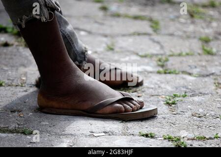 Tegucigalpa, Honduras. 16 juillet 2021. Les pieds d'un migrant finissent par être maltraités après de longues journées sur le chemin. Tegucigalpa, Honduras. Plus de 120 migrants, principalement d'origine haïtienne et un petit nombre de Cubains, sont arrivés hier dans la capitale Tegucigalpa pour poursuivre leur voyage migratoire vers les États-Unis. Après avoir été entrés dans le territoire hondurien, ils ont arrêté pendant quelques heures leur marche dans l'un des bureaux de l'Institut national des migrations (INM) où ils ont reçu un comportement sûr pour pouvoir traverser le Honduras. (Credit image: © Milo Espinoza/ZUMA Press Wire) Banque D'Images