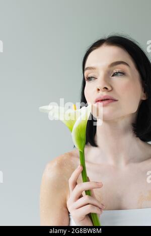 Femme avec le vitiligo tenant la fleur de cala et regardant loin isolé sur gris Banque D'Images