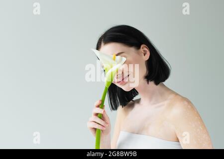 Femme avec le vitiligo couvrant le visage avec cala lys isolé sur le gris Banque D'Images