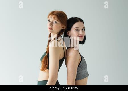 Freckled et sportswoman avec vitiligo debout dos à dos isolé sur gris Banque D'Images