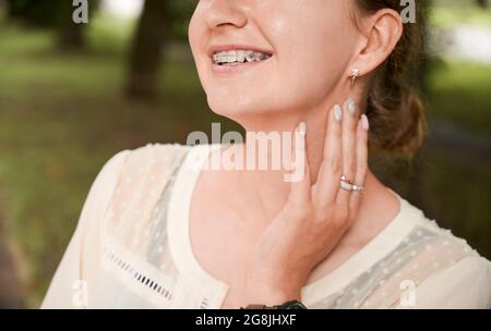 Gros plan, petit aperçu du sourire d'une femme portant des bretelles dentaires, posant à l'extérieur, sa main sur le cou. Image horizontale. Concept de l'hygiène buccale et ca Banque D'Images