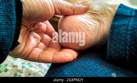 Un homme montre ses talons secs sales et craqués Banque D'Images