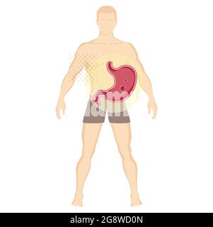 Ulcère peptique - mal d'estomac - Illustration comme fichier EPS 10 Illustration de Vecteur