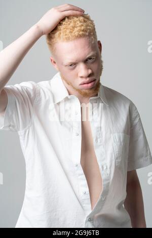 Studio portrait de l'homme albino en chemise blanche Banque D'Images