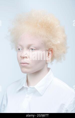 Studio portrait de femme albino en chemise blanche Banque D'Images
