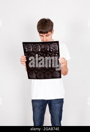 Un jeune homme inquiet tient le scanner à rayons X sur le mur blanc Arrière-plan Banque D'Images