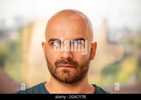 Un homme caucasien tannées avec la tête rasée a un problème avec la peau sur le dessus de sa tête s'écaille en raison de coups de soleil. Il regarde vers le haut et sur le côté Banque D'Images