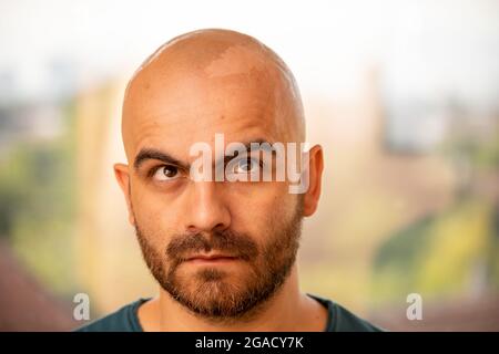 Un homme caucasien tannées avec la tête rasée a un problème avec la peau sur le dessus de sa tête s'écaille en raison de coups de soleil. Il regarde vers le haut et sur le côté Banque D'Images