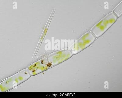 Micrographe d'algues multicellulaires et d'un diatomée provenant d'un échantillon d'eau douce, le champ de vision horizontal est d'environ 121 microns Banque D'Images