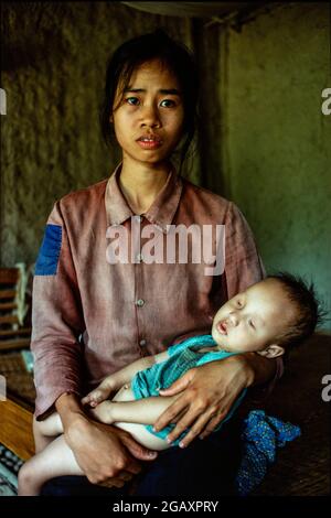 Pham Thi Huan, 24 ans, avec son premier enfant, Bui Van Xuan, a 20 mois. Il ne peut ni parler, ni se lever et n'a pas d'yeux. Son père, Bui Van Tram, 28 ans, un vétéran de la guerre, a été pulvérisé trois fois avec l'agent Orange. Juin 1980 Banque D'Images