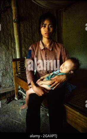 Pham Thi Huan, 24 ans, avec son premier enfant, Bui Van Xuan, a 20 mois. Il ne peut ni parler, ni se lever et n'a pas d'yeux. Son père, Bui Van Tram, 28 ans, un vétéran de la guerre, a été pulvérisé trois fois avec l'agent Orange. Juin 1980 Banque D'Images