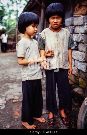Les sœurs lien, 8 ans, et Hien, 6 ans, sont nées après que leur père ait été aspergé pendant la guerre du Vietnam avec l'agent Orange par des avions américains. Ni l'un ni l'autre n'ont de lentilles dans leurs yeux. Banque D'Images