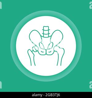 Icône du bouton de couleur arthroplastie. Implant de remplacement de la hanche installé dans l'os du bassin. Elément vectoriel isolé. Illustration de Vecteur