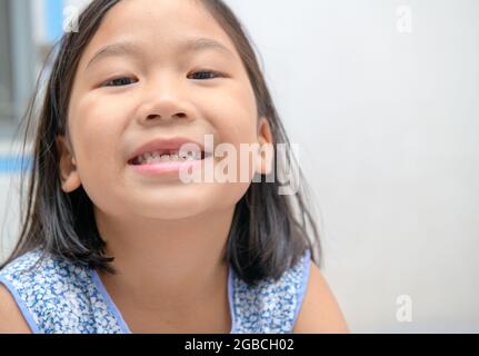 Fille asiatique sourit et montrant ses dents de lait cassées. Jolie fille a perdu ses dents de lait avant. Concept de santé orale . Banque D'Images