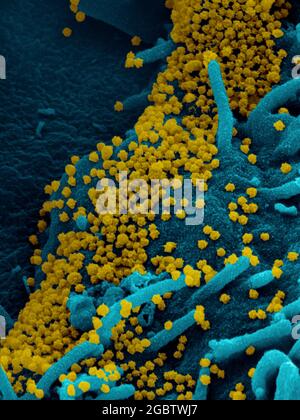 Nouveau coronavirus SARS-CoV-2 cette image au microscope électronique à balayage montre le SARS-CoV-2 (particules d'or rondes) émergeant de la surface d'une cellule cultivée en laboratoire. Le COV-SRAS-2, également connu sous le nom de 2019-nCoV, est le virus responsable de la COVID-19. Image capturée et colorisée aux laboratoires Rocky Mountain à Hamilton, Montana. Crédit : NIAID Banque D'Images