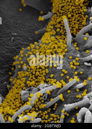 Nouveau coronavirus SARS-CoV-2 cette image au microscope électronique à balayage montre le SARS-CoV-2 (particules d'or rondes) émergeant de la surface d'une cellule cultivée en laboratoire. Le COV-SRAS-2, également connu sous le nom de 2019-nCoV, est le virus responsable de la COVID-19. Image capturée et colorisée aux laboratoires Rocky Mountain à Hamilton, Montana. Crédit : NIAID Banque D'Images