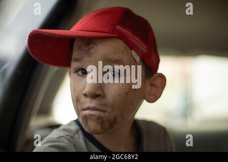 Portrait d'un enfant avec un visage sale à l'intérieur de la voiture. Le garçon ne s'est pas lavé le visage. Un enfant dans une casquette après un incendie. Présence de suie sur la face d'un préchooler. Banque D'Images