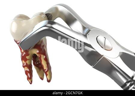 Extraction des dents avec pinces dentaires isolées sur fond blanc. illustration 3d Banque D'Images