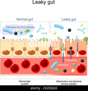 les cellules sur la paroi intestinale sont étroitement liées. dans l'intestin avec la maladie cœliaque et la sensibilité au gluten ces jonctions serrées Illustration de Vecteur