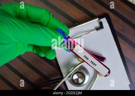 FSH - Test avec échantillon de sang. Vue de dessus isolée sur le bureau. Concept de santé ou de médecine Banque D'Images