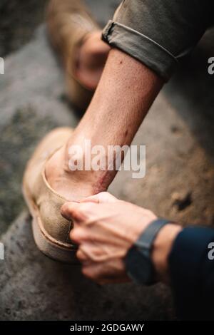 Homme montrant une cicatrice chirurgicale de la blessure du tendon d'achille sur sa jambe Banque D'Images