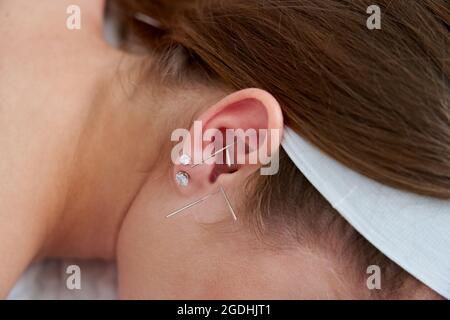 Belle femme se reposant sur un lit ayant un traitement d'acupuncture avec des aiguilles dans et autour de son oreille. Concept de thérapie alternative Banque D'Images