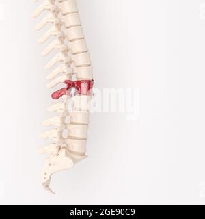 backbone avec vertèbres rouges fragmentées. back problème concept. rendu 3d. Banque D'Images
