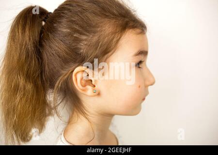 Perçage d'oreilles chez un enfant - une fille montre un anneau auriculaire dans son oreille fait d'un alliage médical. Fond blanc, portrait d'une fille avec une taupe sur sa joue Banque D'Images