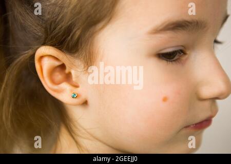 Perçage d'oreilles chez un enfant - une fille montre un anneau auriculaire dans son oreille fait d'un alliage médical. Fond blanc, portrait d'une fille avec une taupe sur sa joue Banque D'Images