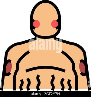 illustration vectorielle de l'icône de couleur de l'endocrinologie de la maladie de cushing Illustration de Vecteur