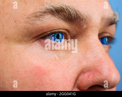 Concept ophtalmologiste. Œil de Mans avec lentille de contact, gros plan. Homme aux yeux bleus Banque D'Images