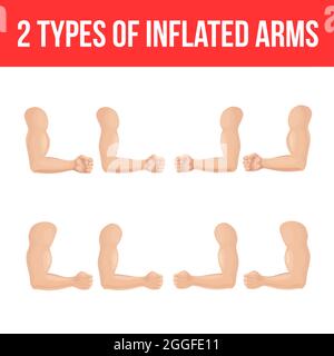 Musculature du bras courbée, style dessin animé. Jeu de gestes de la main des deux côtés Illustration de Vecteur