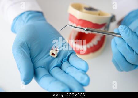Dentiste médecin main dans le gant montre la proximité des dents Banque D'Images