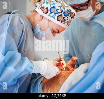 Médecins effectuant la chirurgie de l'abdominoplastie dans la clinique moderne. Chirurgien et assistant en plastique portant des masques médicaux et des gants stériles lors de la chirurgie abdominale en plastique dans la salle d'opération. Banque D'Images