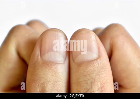 Gros lunulae ou demi-lunes aux ongles avec lignes longitudinales du jeune homme chinois d'Asie du Sud-est. Isolé sur fond blanc. Banque D'Images