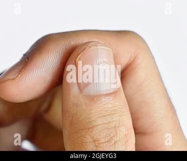 Grands lunulae ou demi-lune à l'ongle avec lignes longitudinales du jeune homme chinois d'Asie du Sud-est. Isolé sur fond blanc. Banque D'Images