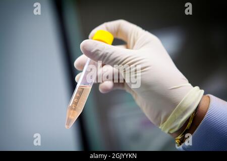 Laboratoire développant des vaccins thérapeutiques pour le traitement du cancer du poumon en stimulant le système immunitaire. Banque D'Images