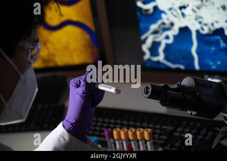 Test sanguin pour la syphilis causée par la bactérie treponema pallidum ou treponema pâle. Cette infection est transmise sexuellement. Banque D'Images