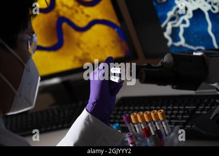 Test sanguin pour la syphilis causée par la bactérie treponema pallidum ou treponema pâle. Cette infection est transmise sexuellement. Banque D'Images