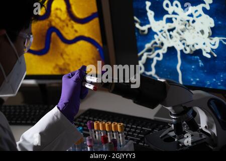 Test sanguin pour la syphilis causée par la bactérie treponema pallidum ou treponema pâle. Cette infection est transmise sexuellement. Banque D'Images