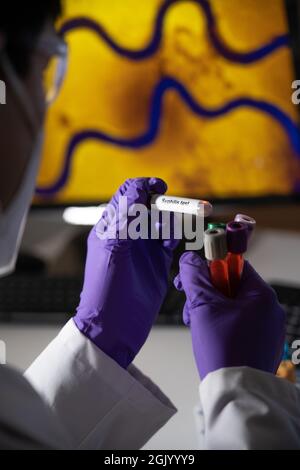 Test sanguin pour la syphilis causée par la bactérie treponema pallidum ou treponema pâle. Cette infection est transmise sexuellement. Banque D'Images